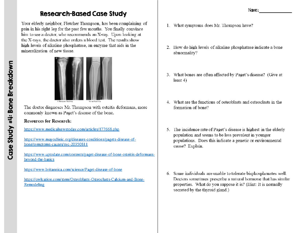 Paget's Disease Case Study Student Research1 medicalnewstoday