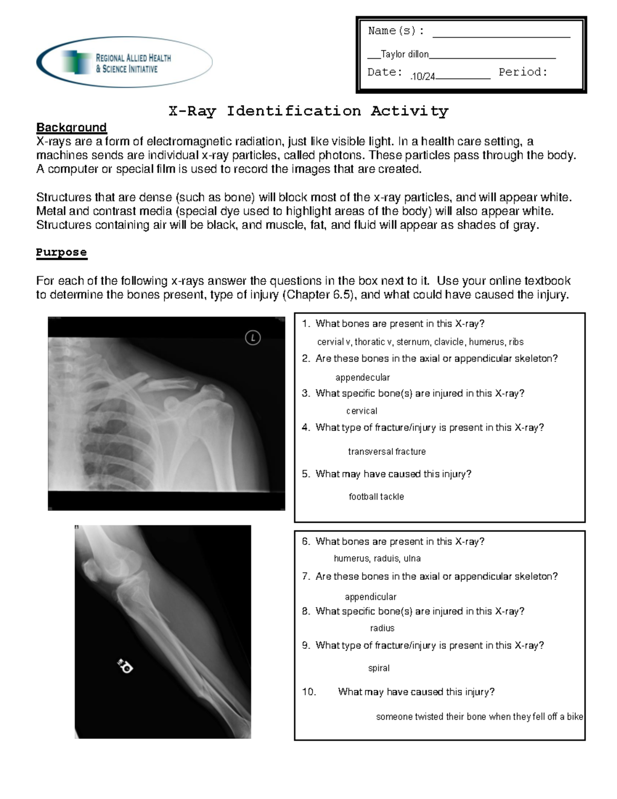 XRay ID Lab Anatomy XRay Identification Activity Background Xrays