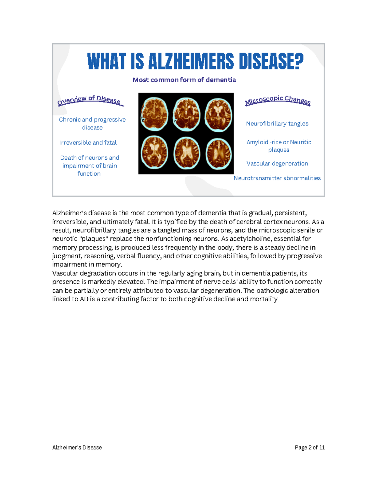 View of Alzheimer's Disease Overview - Study Material for ALZ 101 - WHAT IS ...