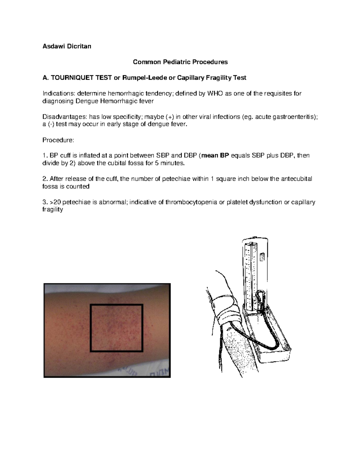 363664333TourniquetTest Asdawi Dicritan Common Pediatric Procedures