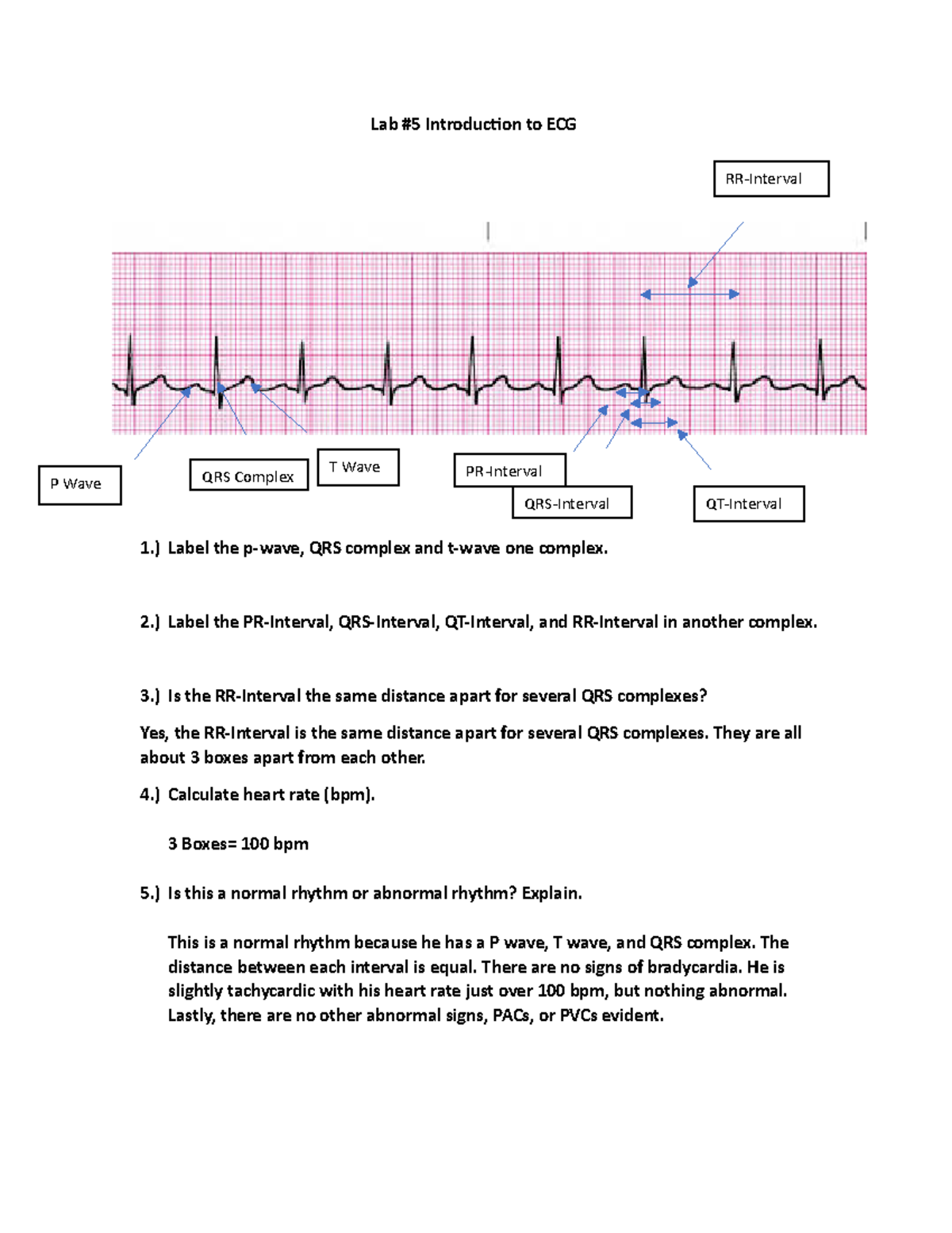 Lab ECG - Lab for ECG - Lab #5 Introduction to ECG 1.) Label the p-wave ...