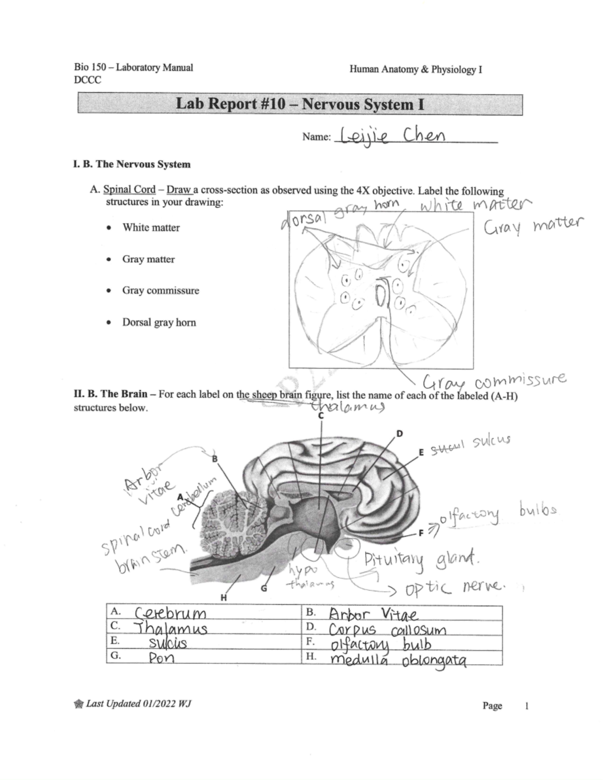 Document lab report 10 Bio 150 Laboratory Manual Human Anatomy