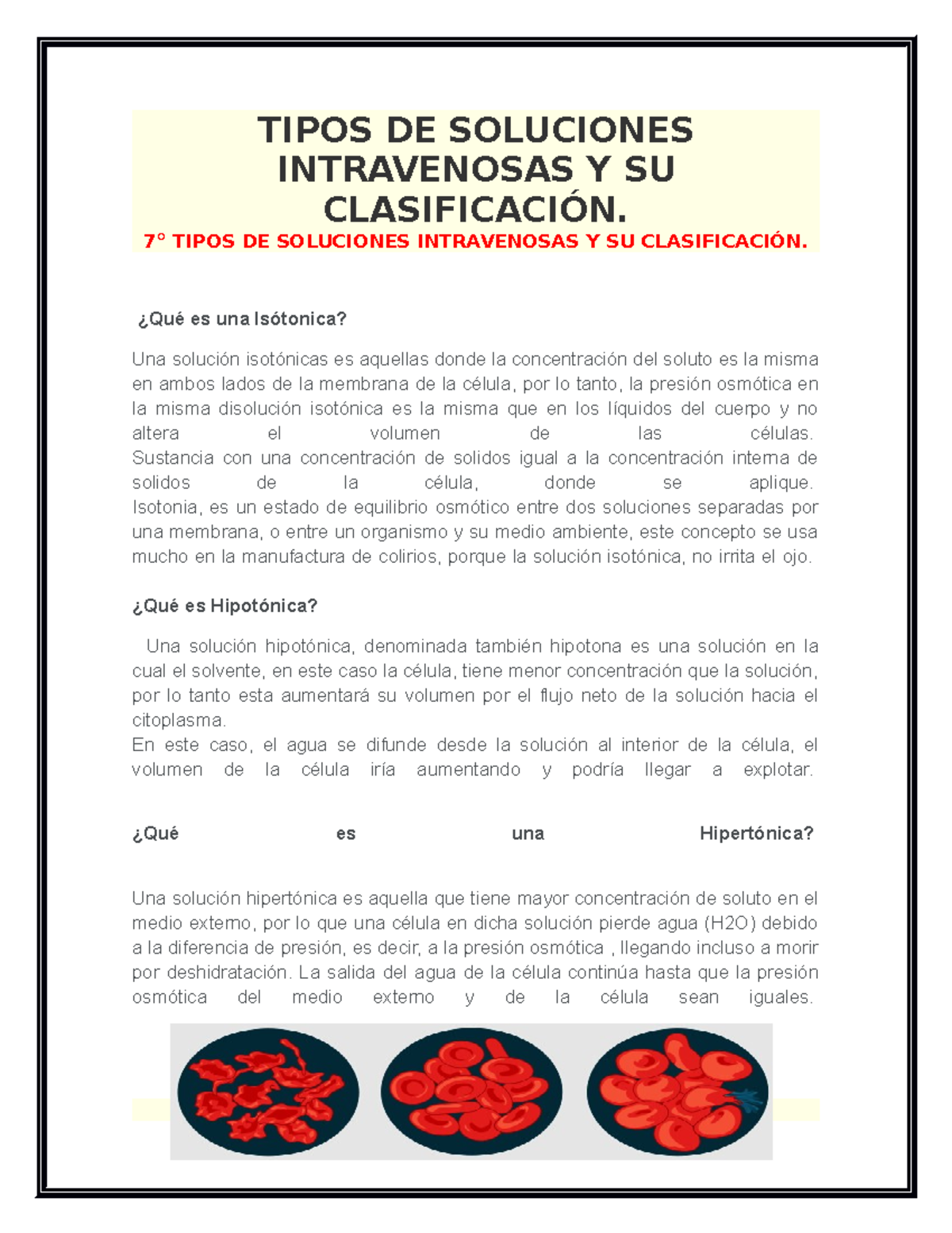 Tipos DE Soluciones Intravenosas Y SU ClasificaciÓn 123