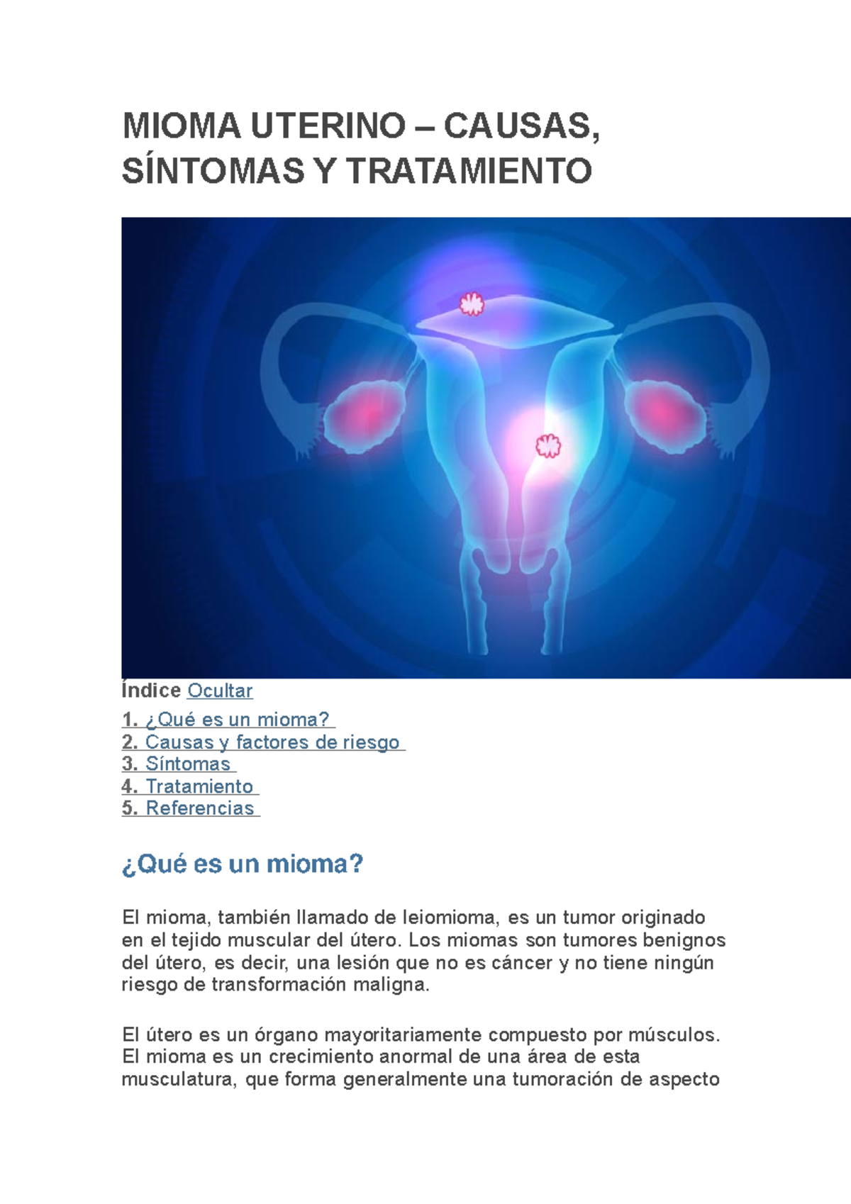 Miomas Uterinos Causas Sг Ntomas Y Tratamiento Miomas Uterinos ...