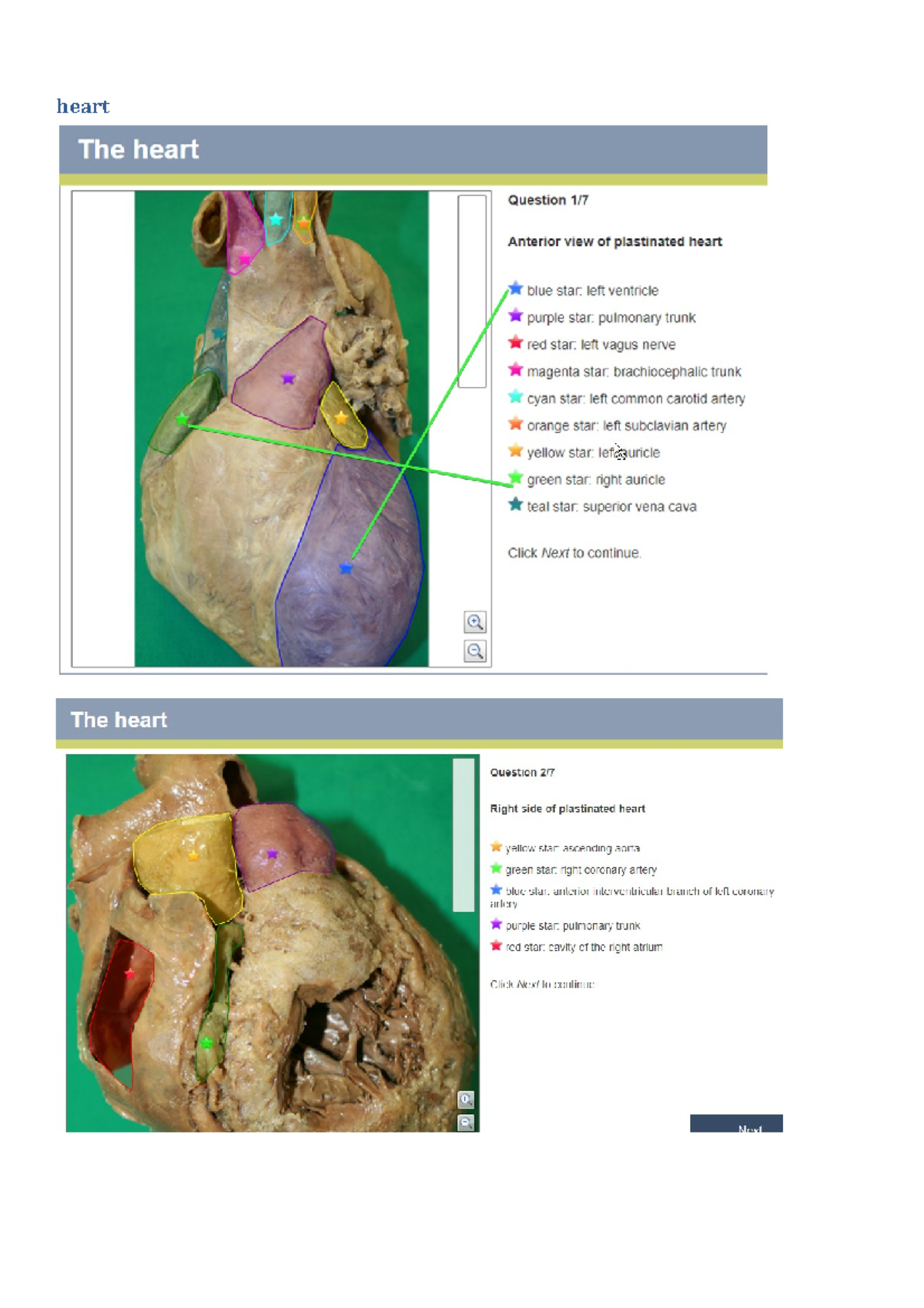 Adaptive-tutorial-heart-resp-system-answers - ANAT2111 - Heart ...