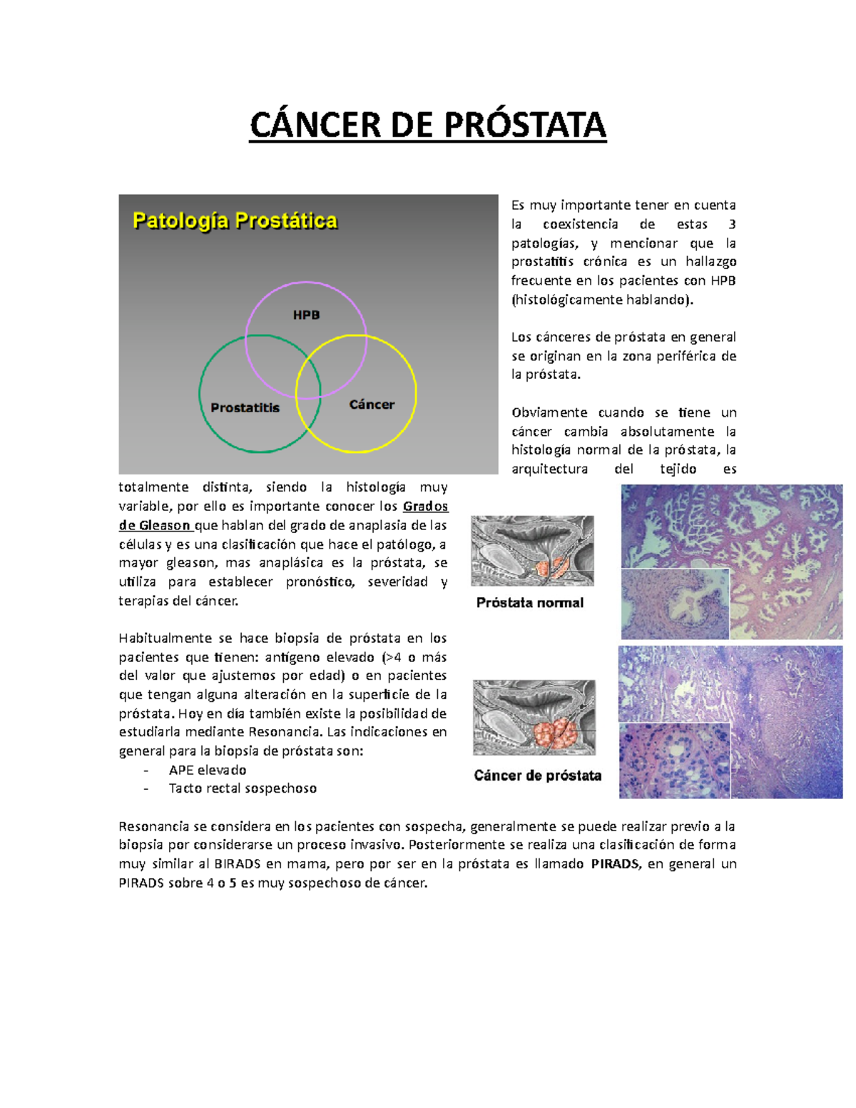 índice de agrandamiento de próstata 1