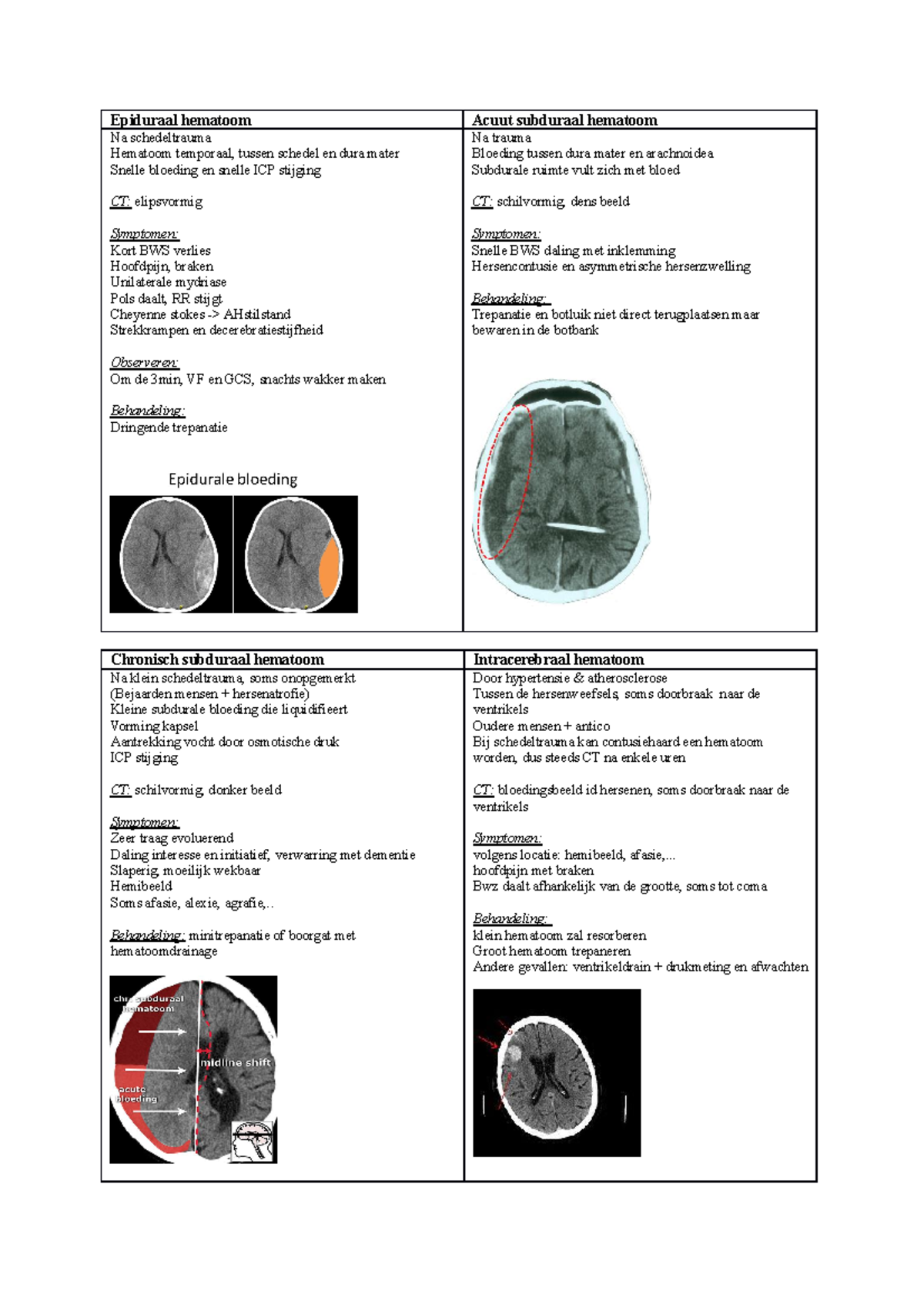 soorten hematomen Epiduraal hematoom Acuut subduraal hematoom Na schedeltrauma Hematoom soorten hematomen Epiduraal hematoom Acuut subduraal hematoom Na schedeltrauma Hematoom