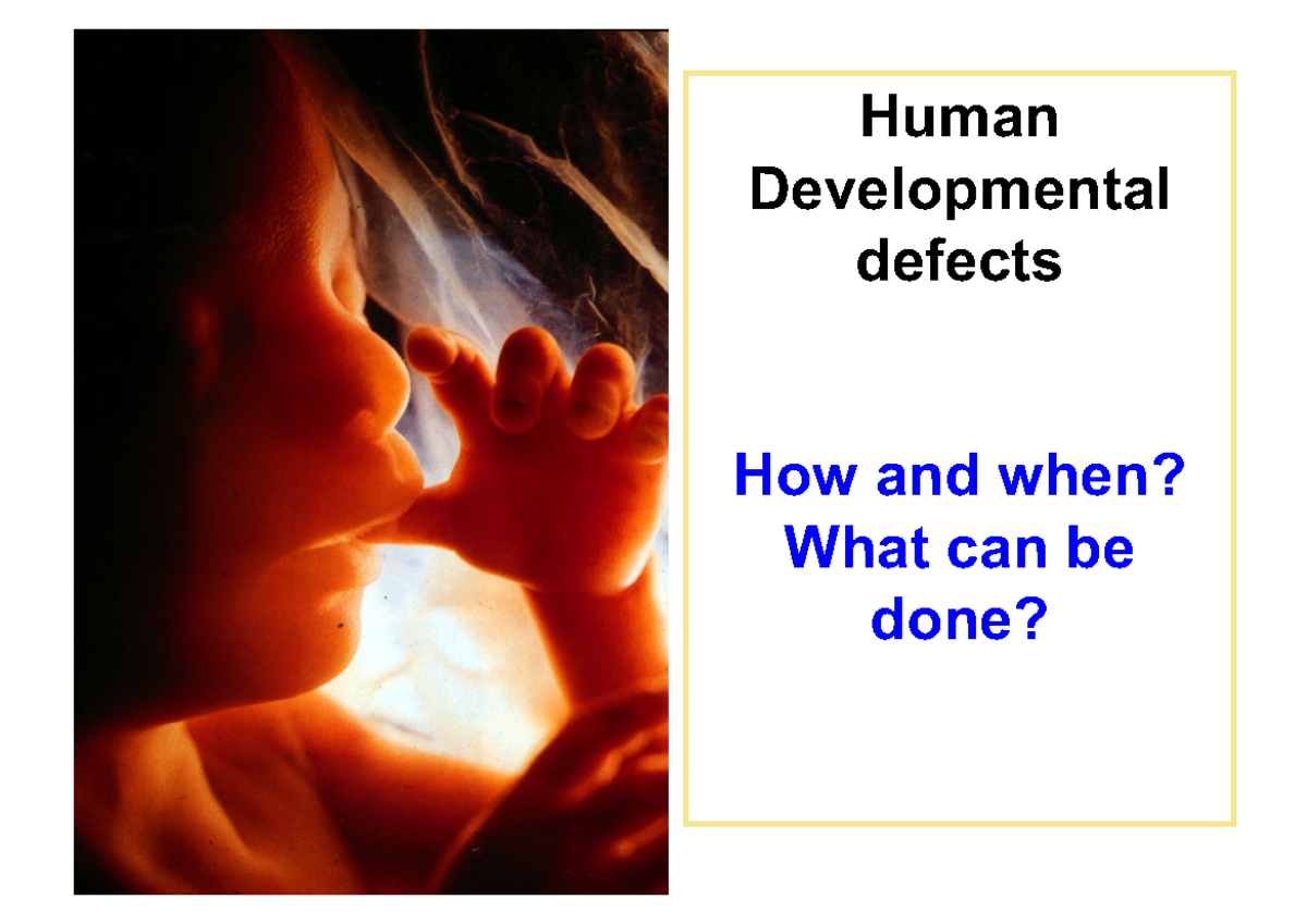 BD L3 - birth defects - Human Developmental defects How and when? What ...