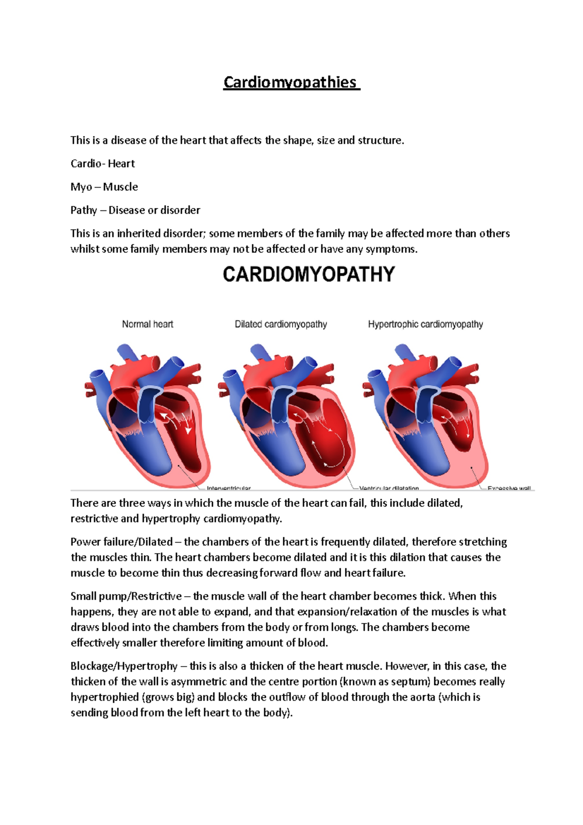 Cardiomyopathies - Biomed notes - Cardiomyopathies This is a disease of ...