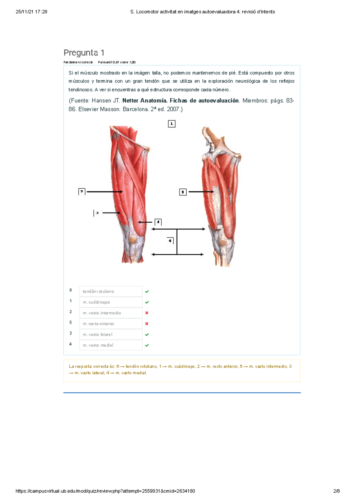 S. Locomotor autoevaluadora 4 - Pregunta 1 Parcialment correcte ...