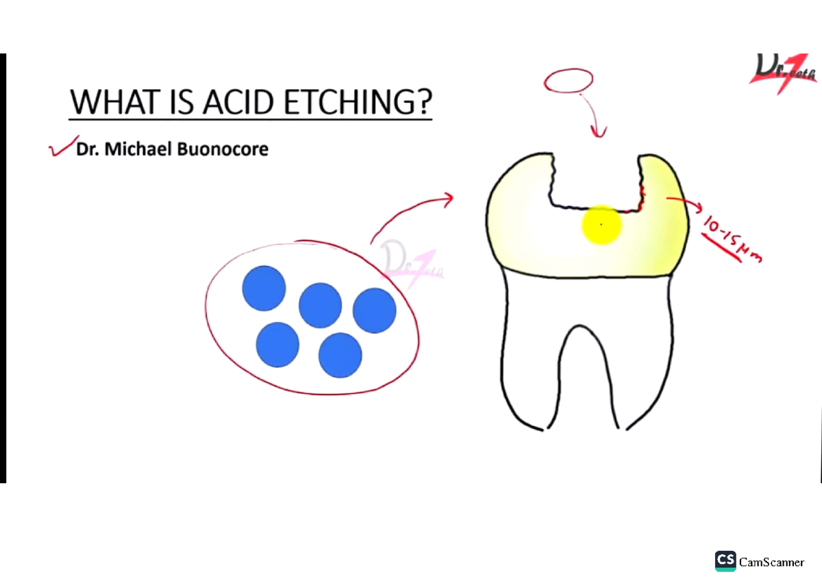 4-Acid etching - Acid etch techniques - dental science - Studocu