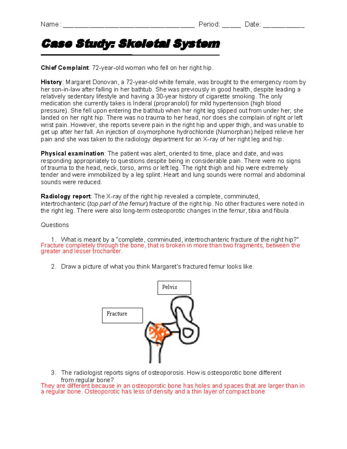 assignment 5 2 skeletal system case studies