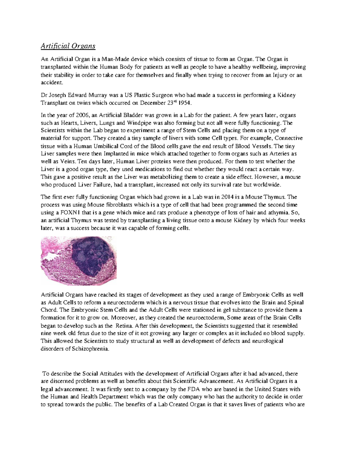 Artificial organs The Organ is transplanted within the Human Body for