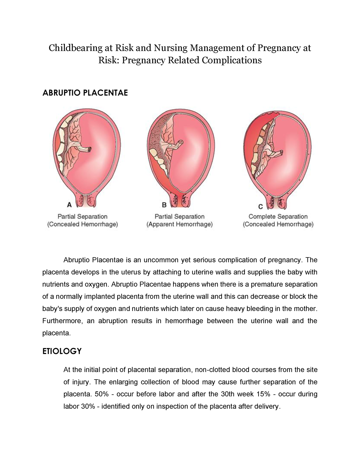 Abruptio Placentae Childbearing at Risk Nursing Management of