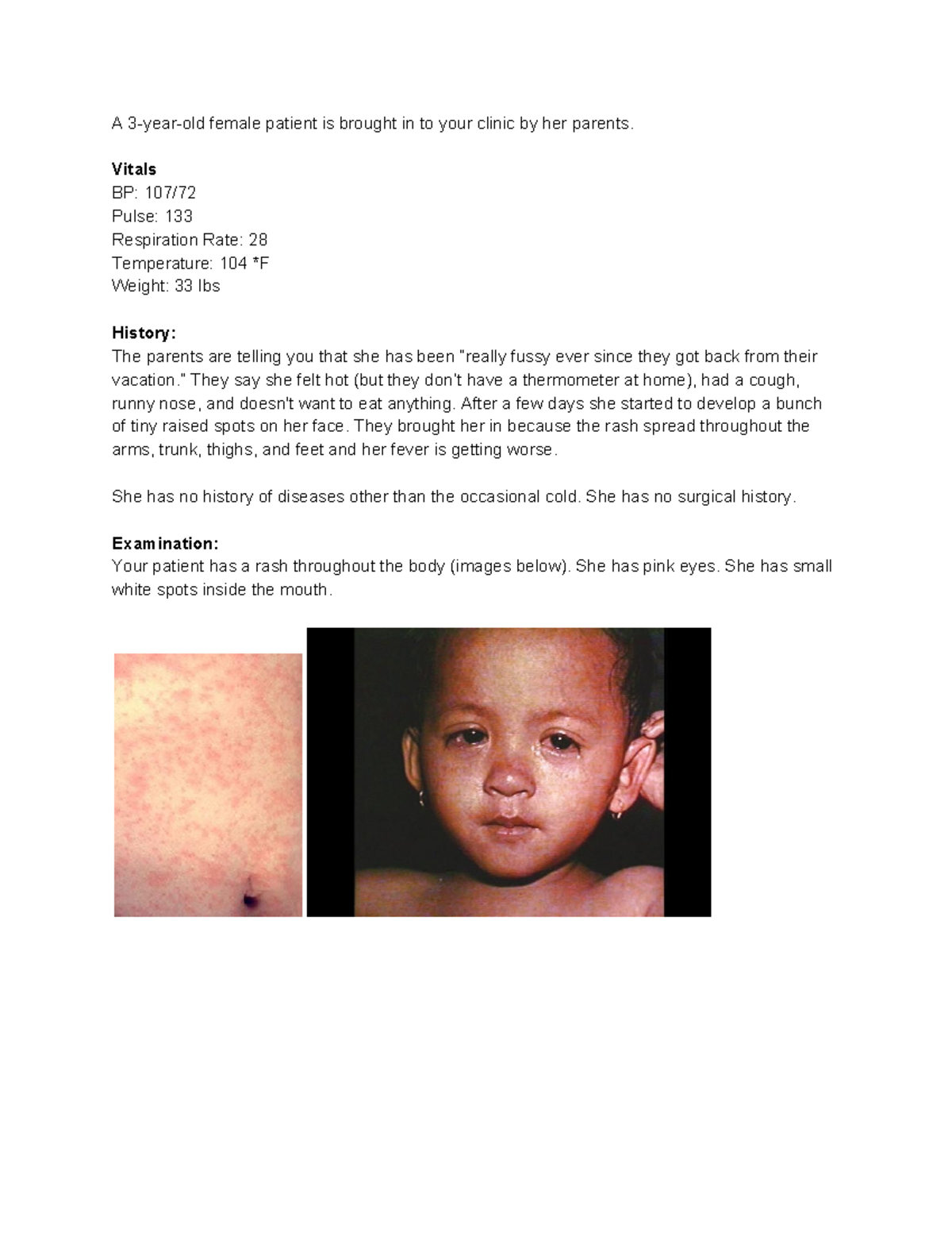 case-study-3-yo-rash-a-3-year-old-female-patient-is-brought-in-to