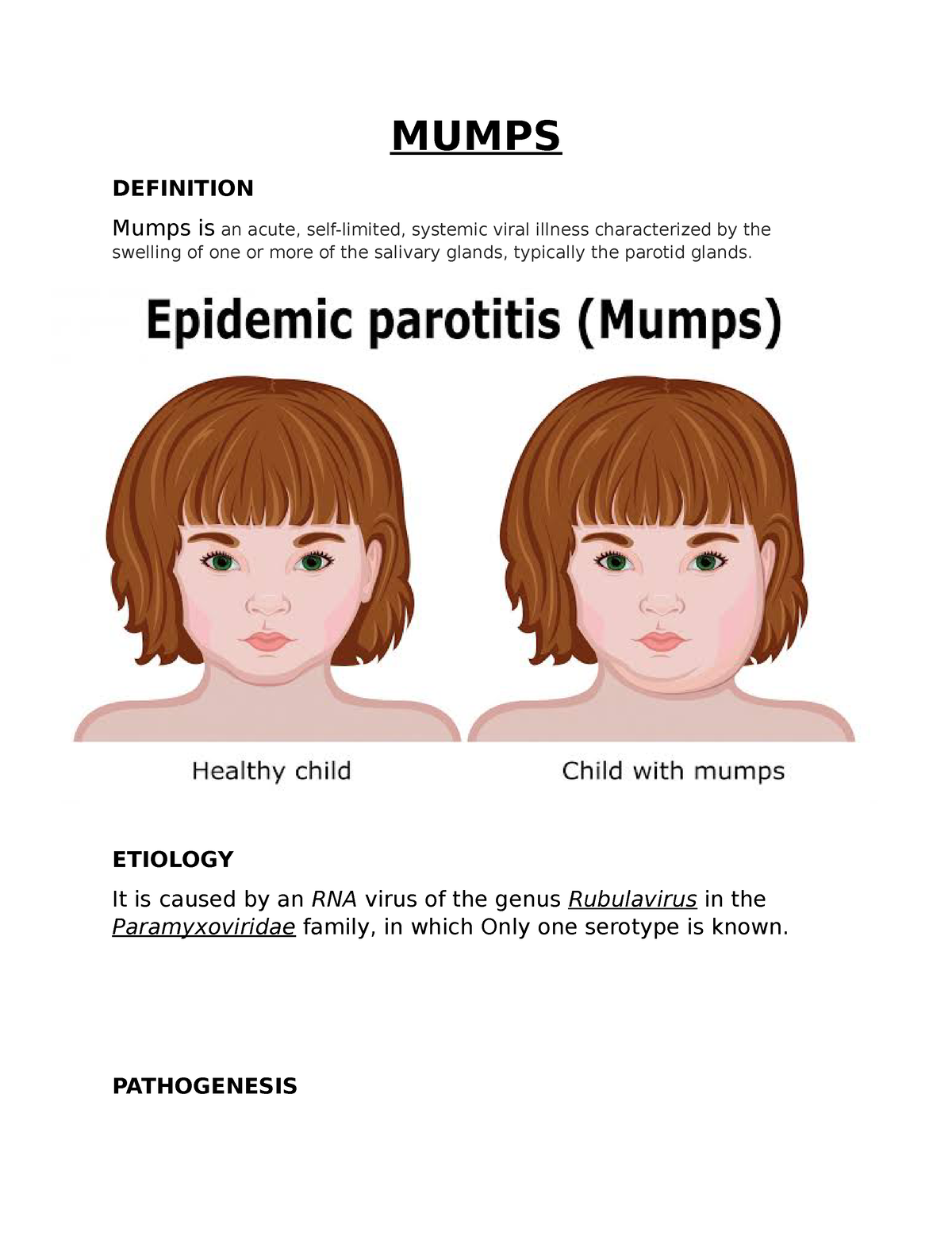 mumps introduction for assignment