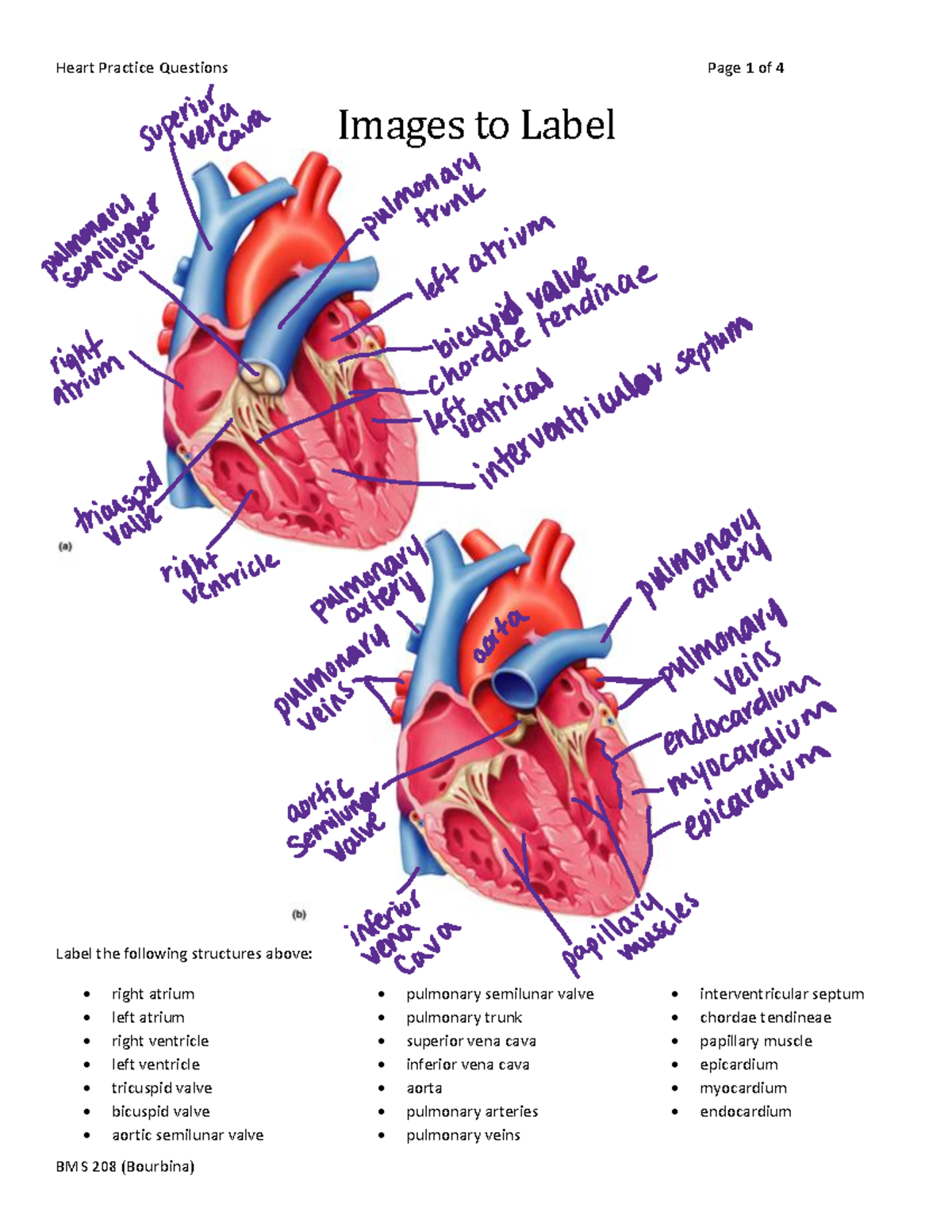 Heart Practice Questions - _____________________________ 2