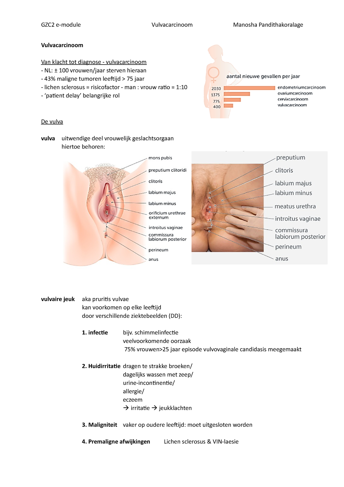 E-Module Vulvacarcinoom - Vulvacarcinoom Van Klacht Tot Diagnose -  Vulvacarcinoom Nl: ± 100 - Studeersnel