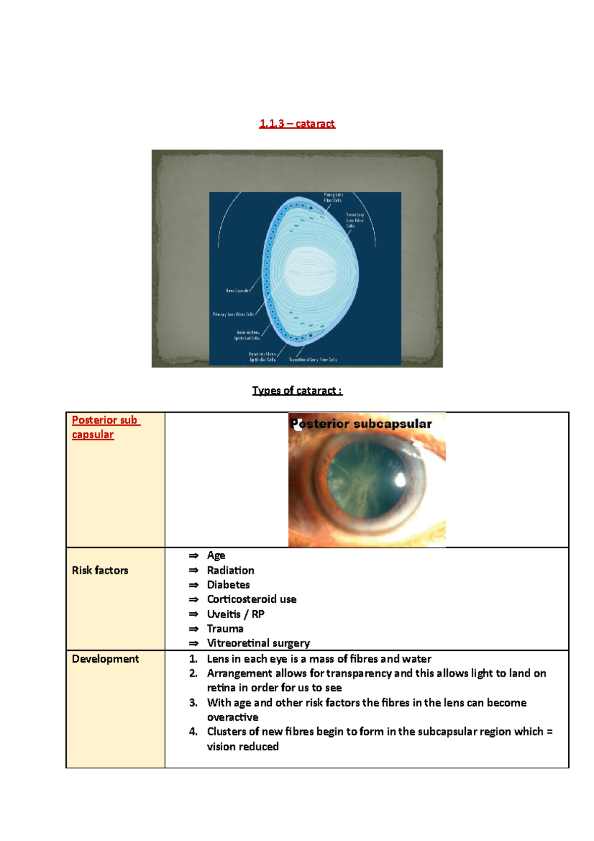 Cataract - N/A - 1.1 – Cataract Types Of Cataract : Posterior Sub ...