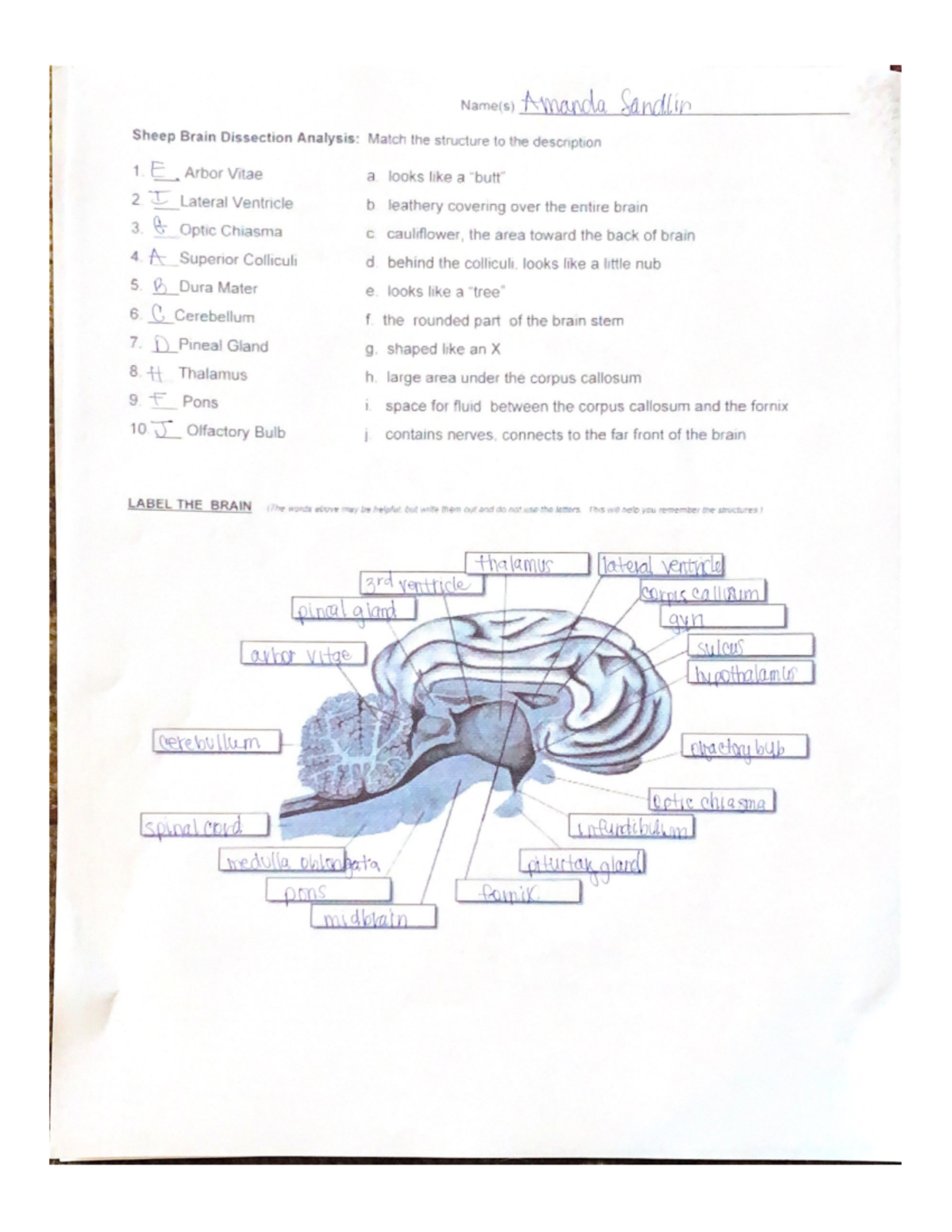 Sheep Brain Dissection Analysis Match Arbor Vitae LD Lateral