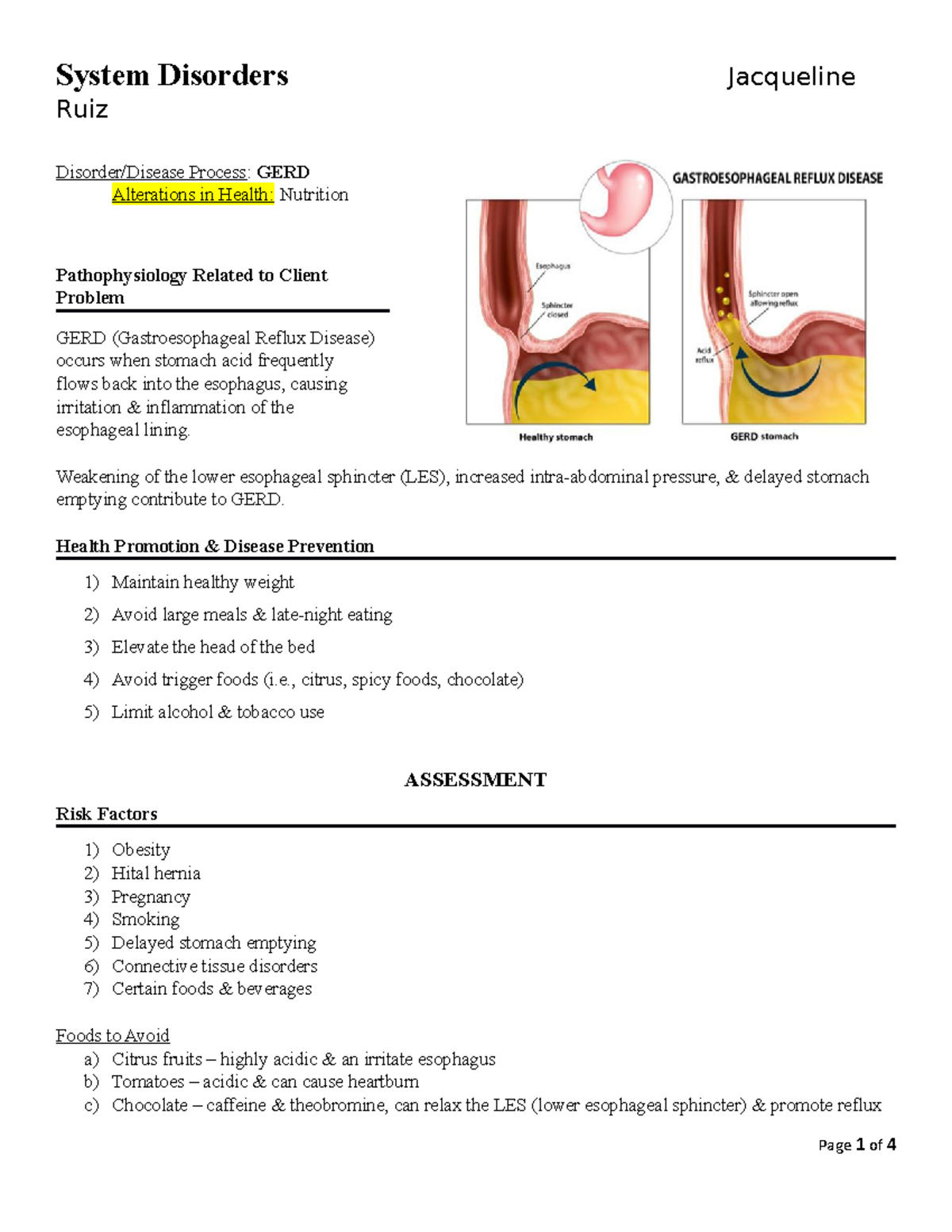 Nursing Systems Disorder GERD System Disorders Jacqueline Ruiz