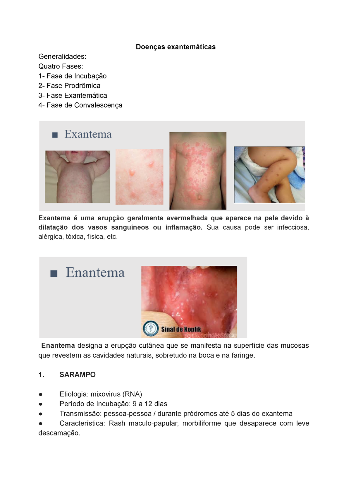 Ped Doenças Exantemáticas Doenças Exantemáticas Generalidades Quatro Fases 1 Fase De 2612
