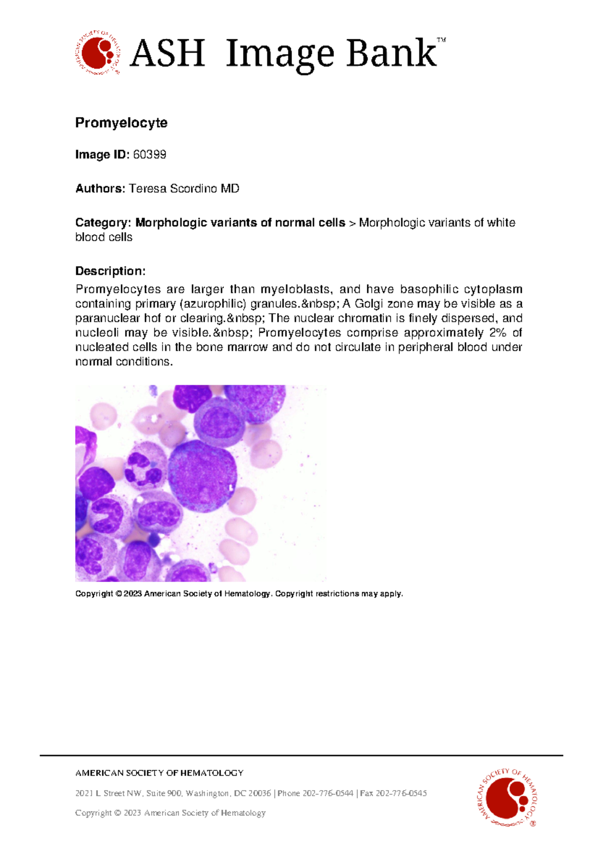 60399-Promyelocyte - Promielocitos - AMERICAN SOCIETY OF HEMATOLOGY ...