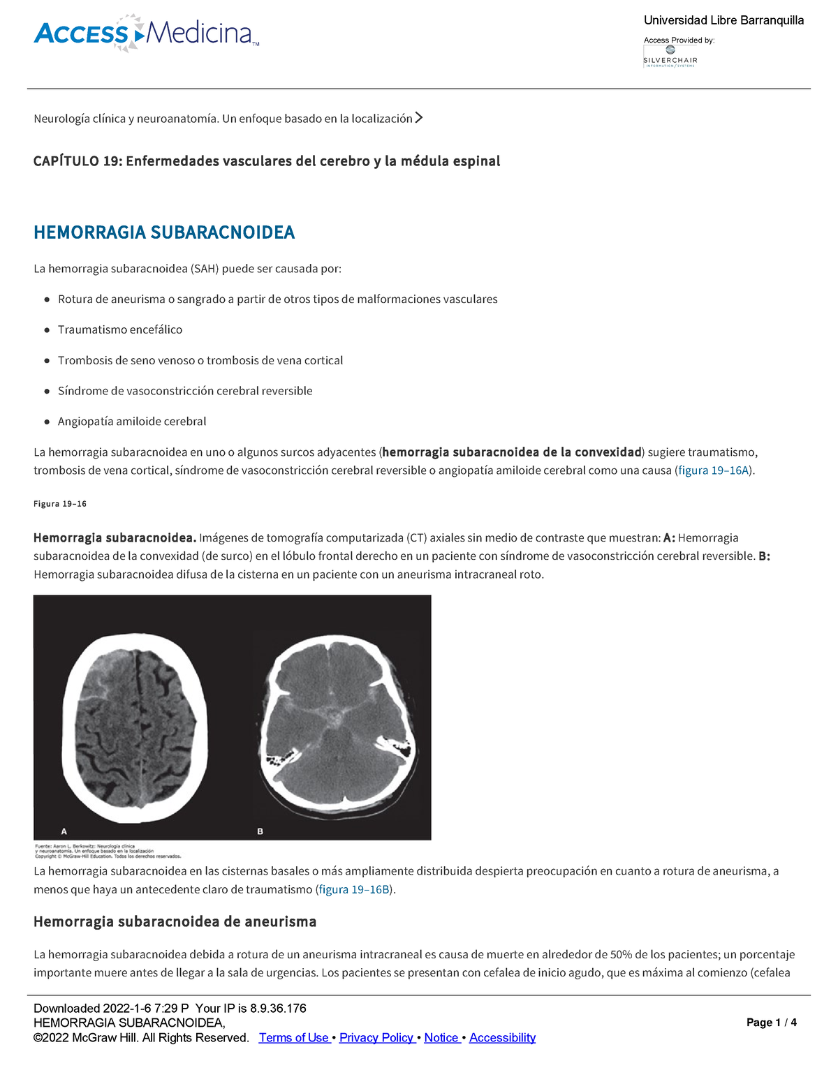 Hemorragia Subaracnoidea - Neurología Clínica Y Neuroanatomía. Un ...