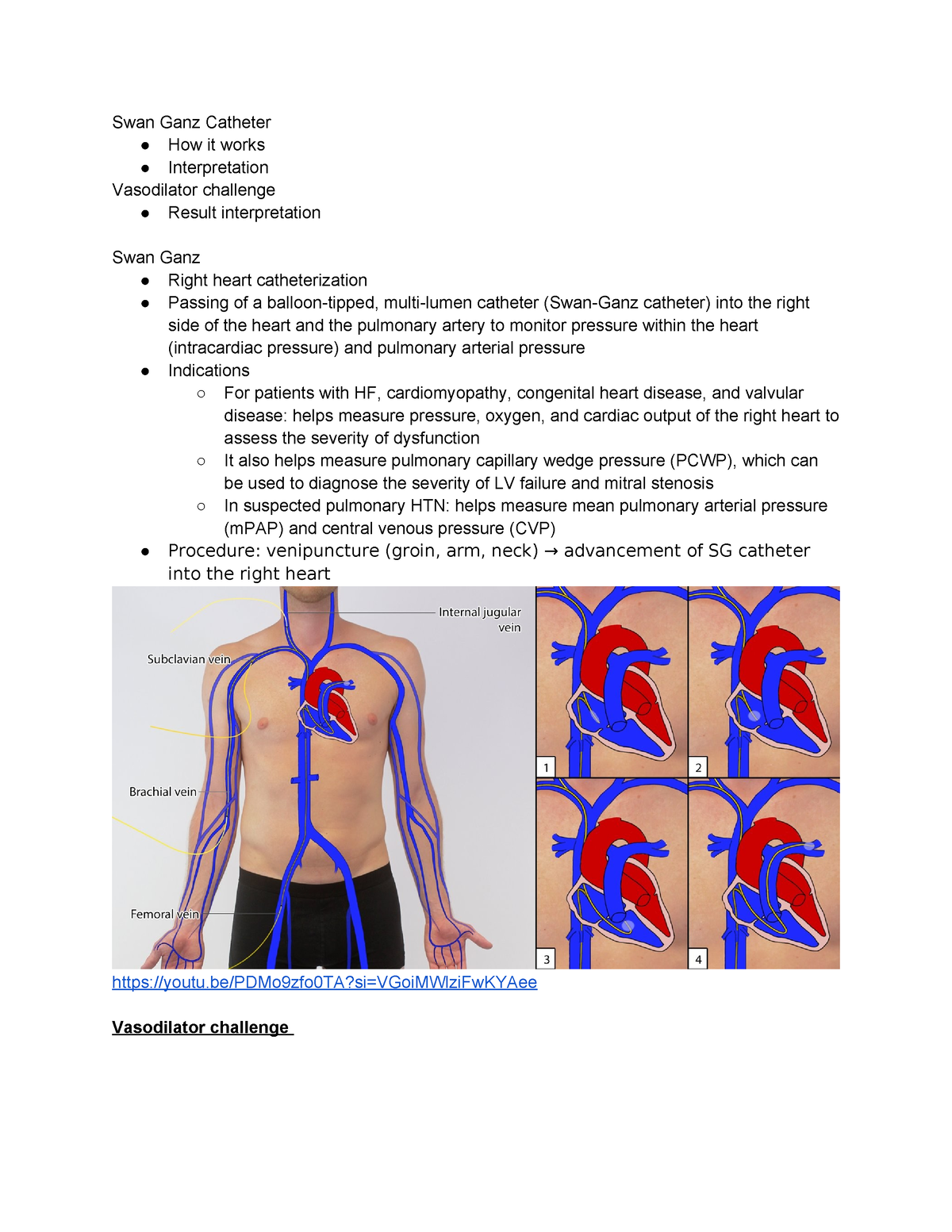 Swan Ganz Catheter Challenge - Swan Ganz Catheter How it works ...