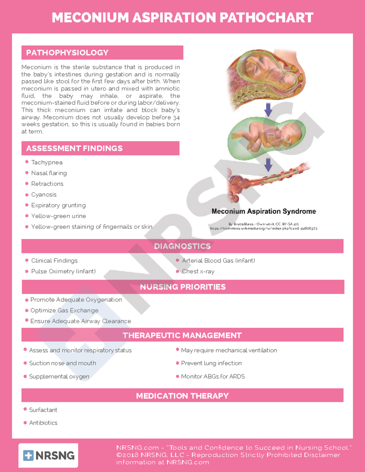 Meconium pathophyisiology - MECONIUM ASPIRATION PATHOCHART NRSNG ...