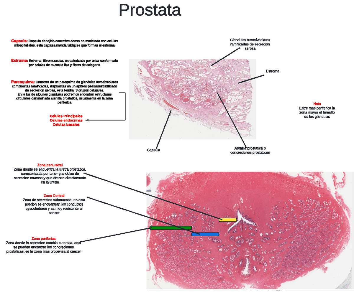 Repaso de corte histológico de próstata - Prostata Capsula: Capsula de ...