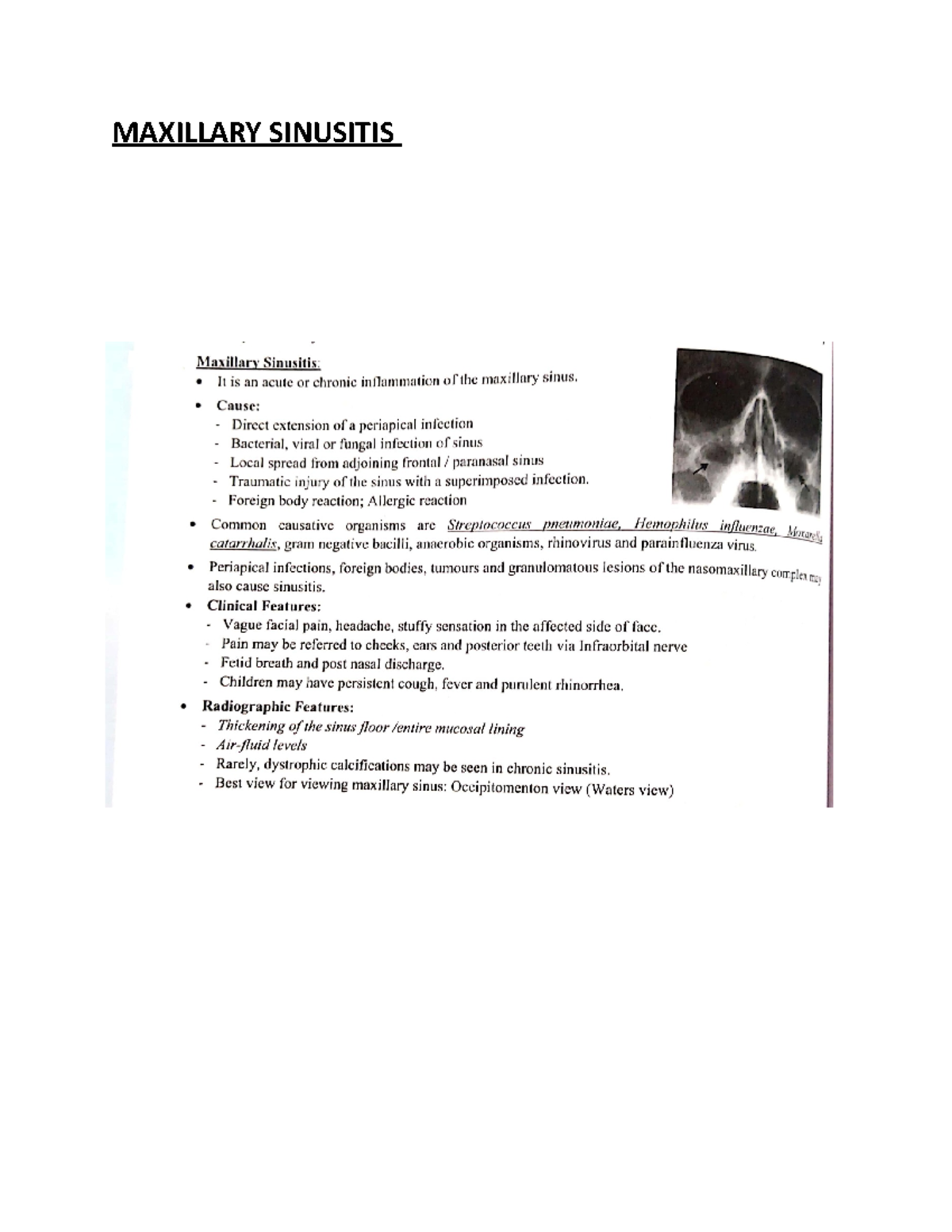 Maxillary sinusitis - Dental surgery - MAXILLARY SINUSITIS - Studocu