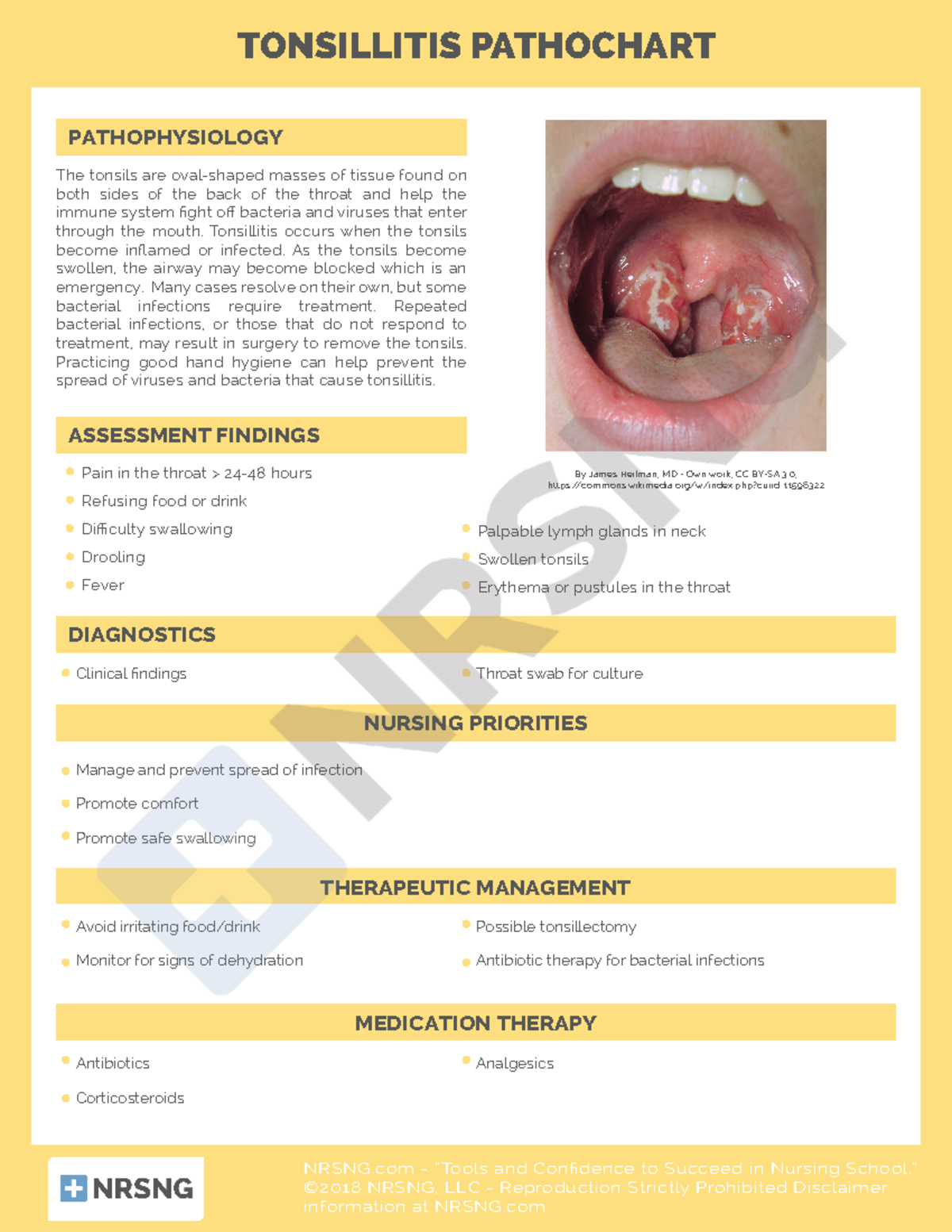 Csent003tonsilitis pathochart TONSILLITIS PATHOCHART The tonsils