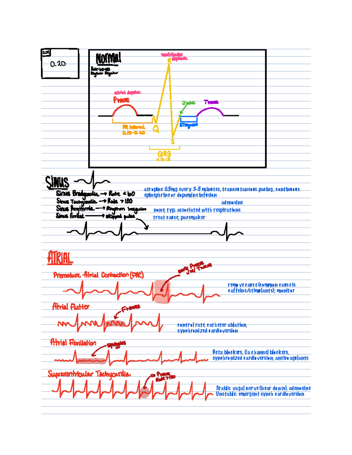 ECG interpretation - ra oMdlvenptriaeupoiarari RhythmRegular ...