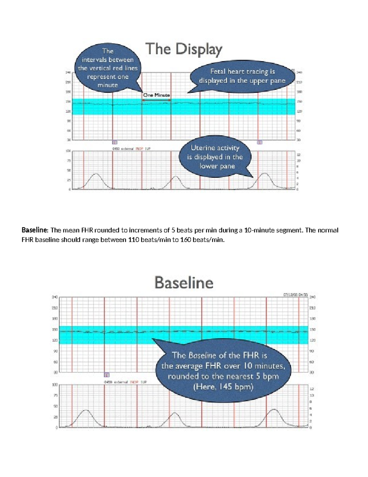 FHM case study KEY - FHM - Baseline: The mean FHR rounded to increments ...