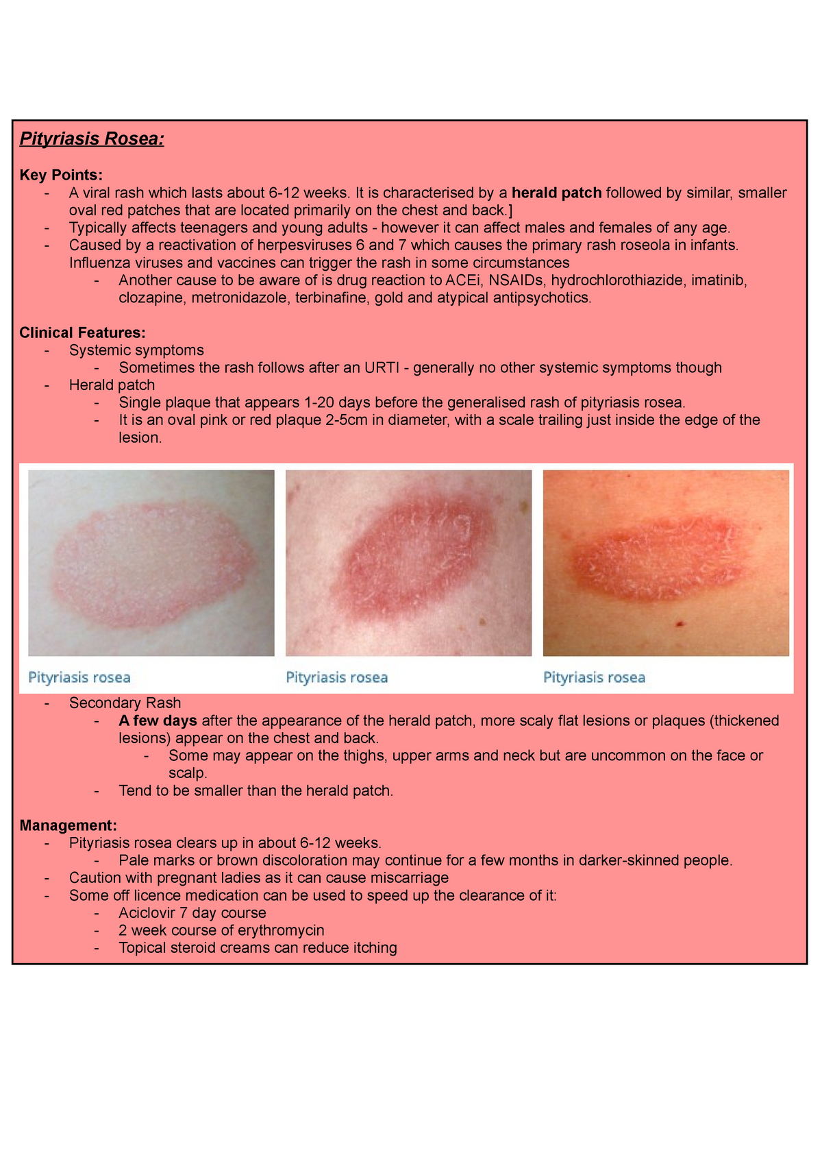 Pityriasis Rosea Lecture Notes Year 4 Dermatology Pityriasis Rosea
