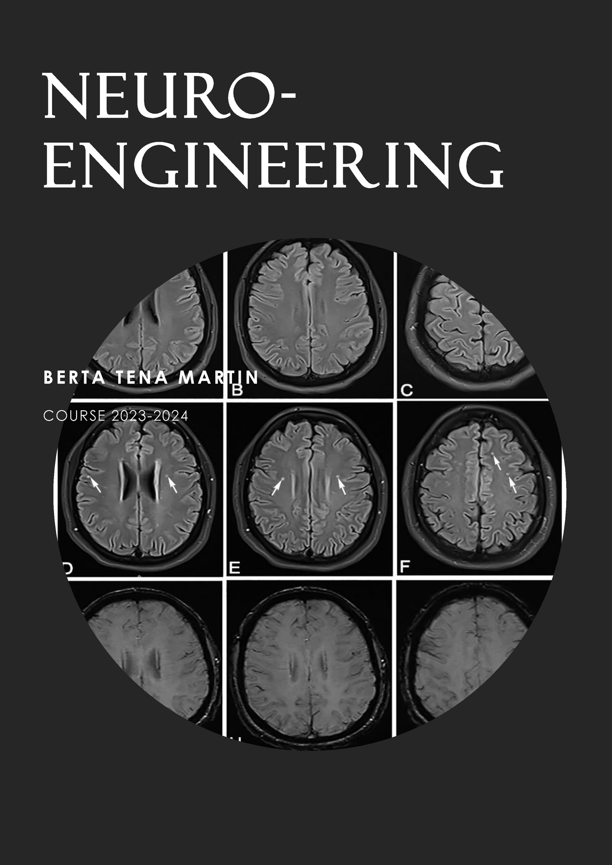 neuroengineering-neuro-engineering-b-e-r-t-a-t-e-n-a-m-a-r-t-i-n