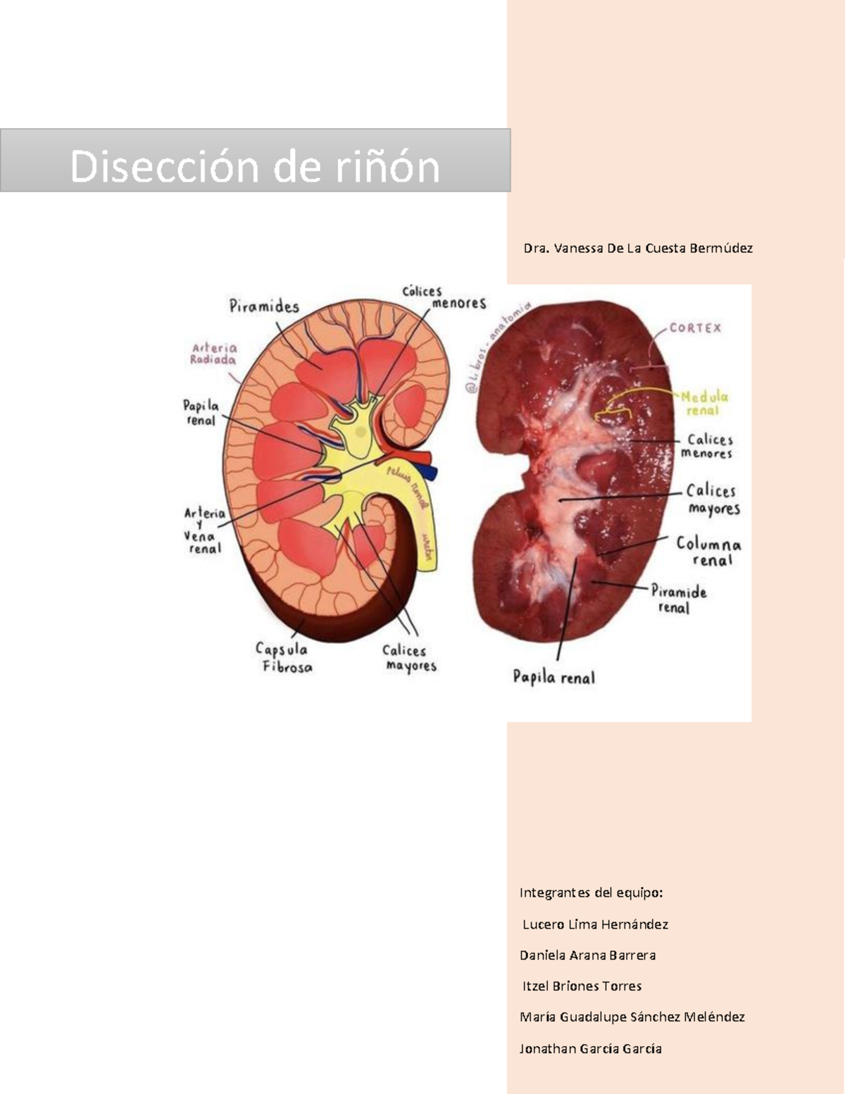 Disección de riñon - DisecciÛn de riÒÛn Dra. Vanessa De La Cuesta Berm ...
