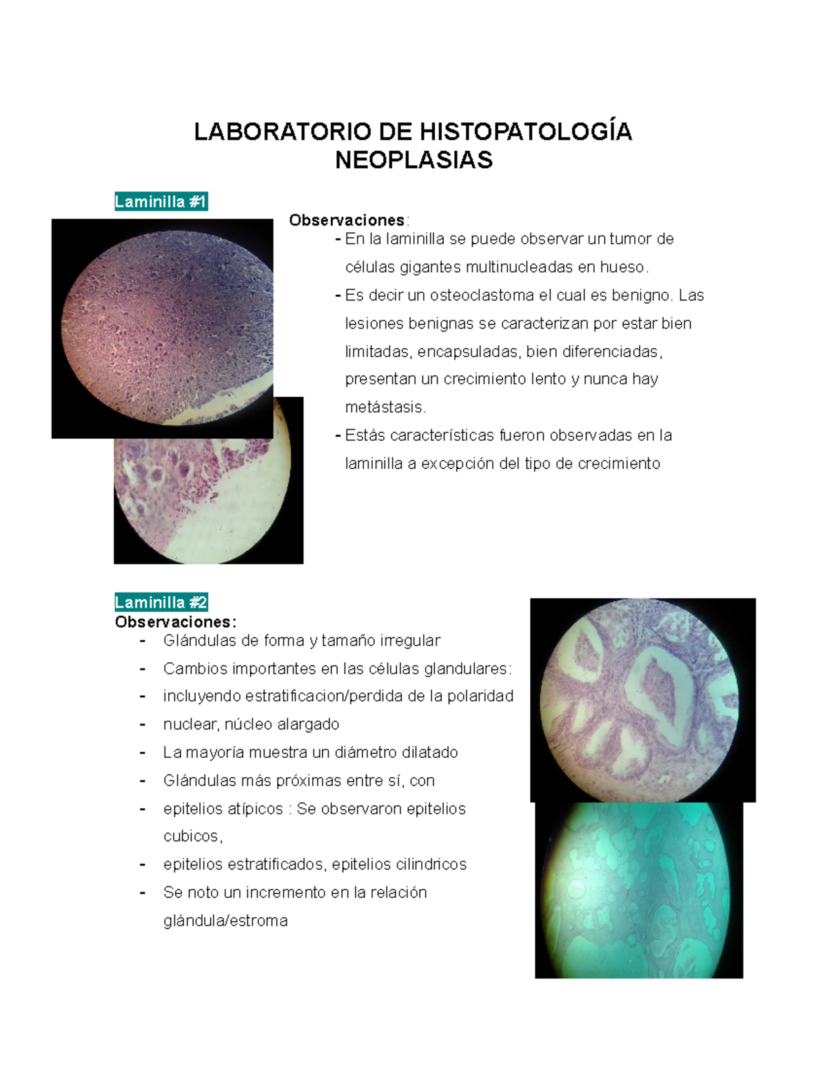 Lab Histopatología-Neoplasias - LABORATORIO DE NEOPLASIAS Laminilla ...