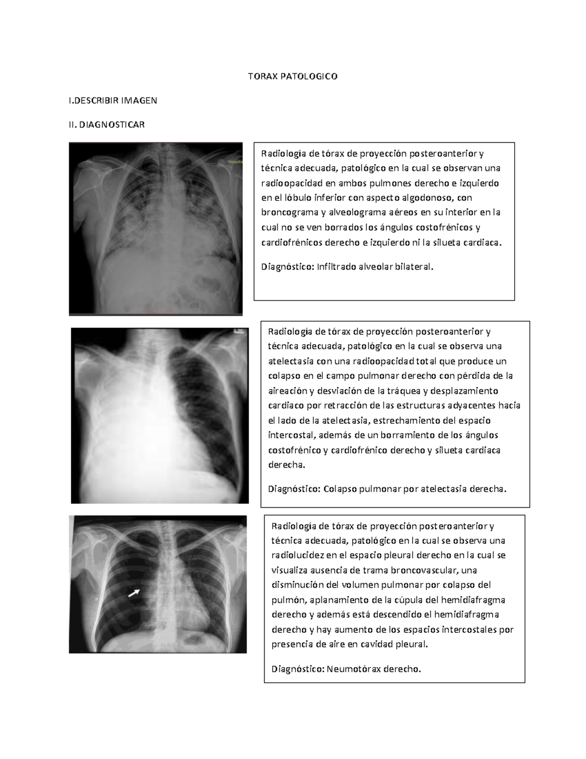 Torax Patologico Tarea TORAX PATOLOGICO I IMAGEN II. DIAGNOSTICAR