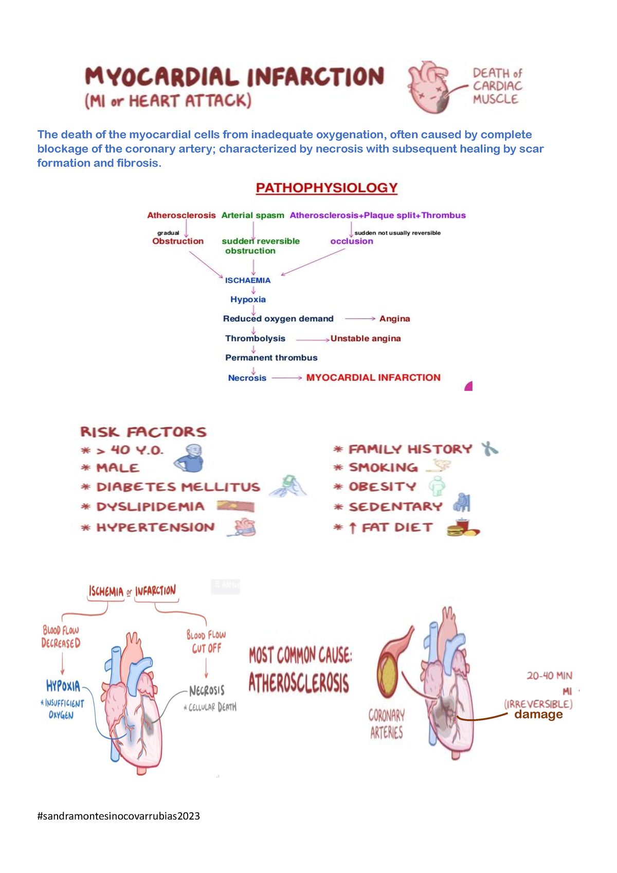 Myocardial Infarction - The death of the myocardial cells from ...