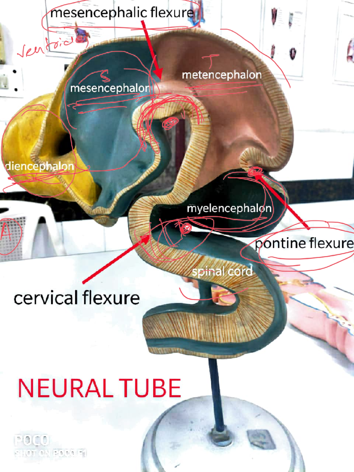 Embryo models - mesencephalic flexure seen metencephalon mesencephalon ...