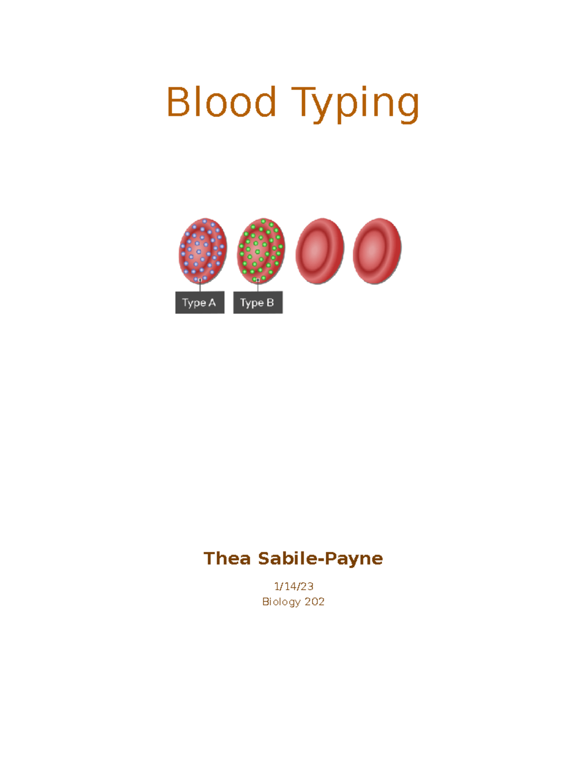 Blood typing lab lab report sheet Blood Typing Thea SabilePayne 1/14/ Biology 202