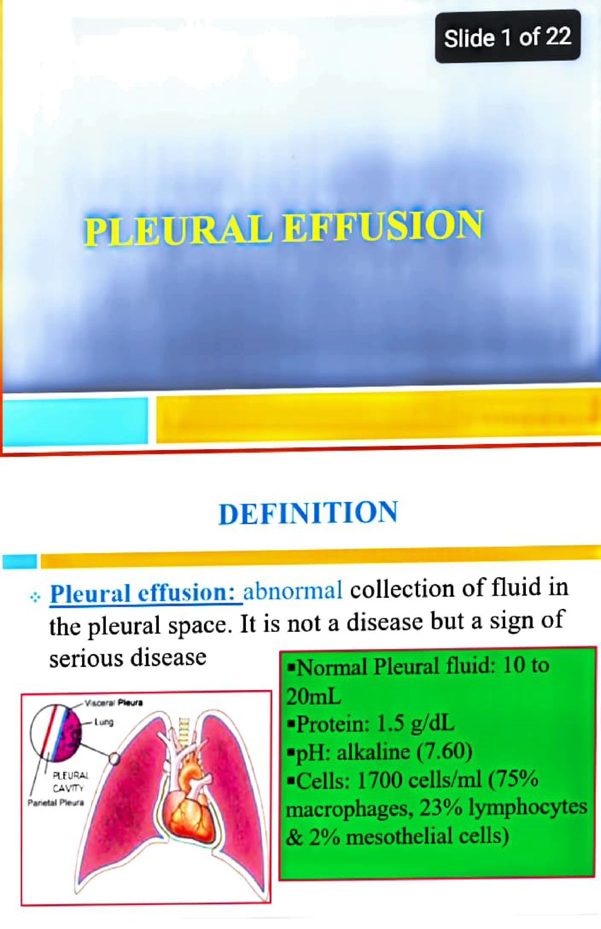 case study on pleural effusion slideshare