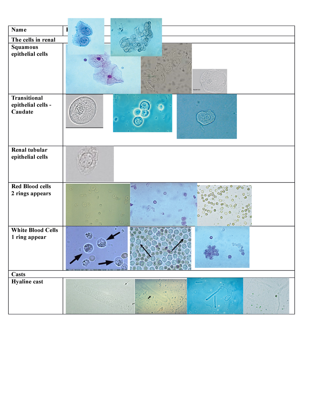 Table Of Pics Urinalysis Name The Cells In Renal Squamous Epithelial Cells Transitional 0368