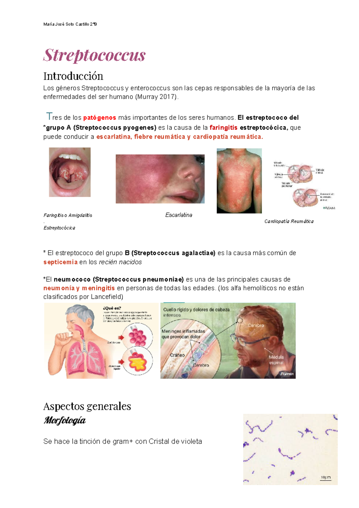 streptococcus-pyogenes-on-agar-hot-sex-picture