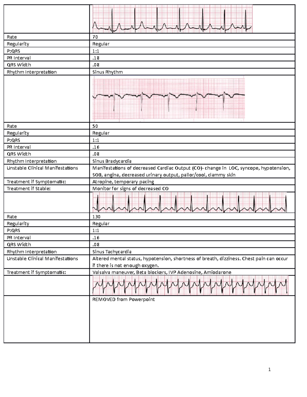 Practice Rhythms Answer Key - Rate 70 Regularity Regular P:QRS 1: PR ...