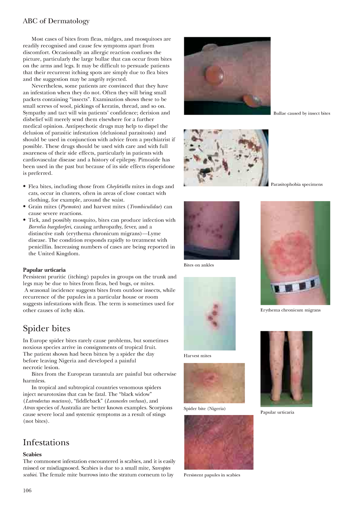 Dermatology-39 - Dermatology - ABC of Dermatology 106 Most cases of ...