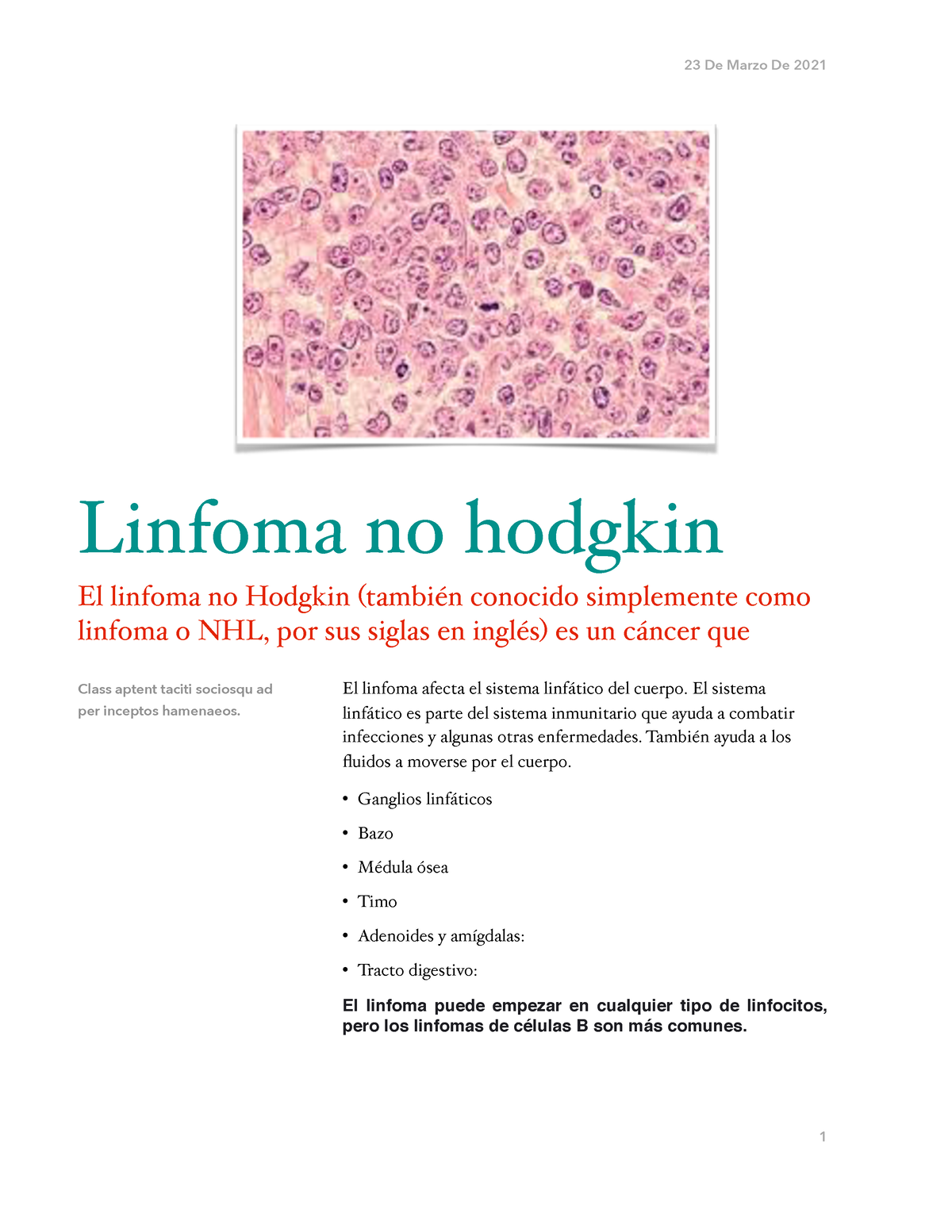 Linfoma NO Hodgkin - Apuntes - 23 De Marzo De 2021 El Linfoma Afecta El ...