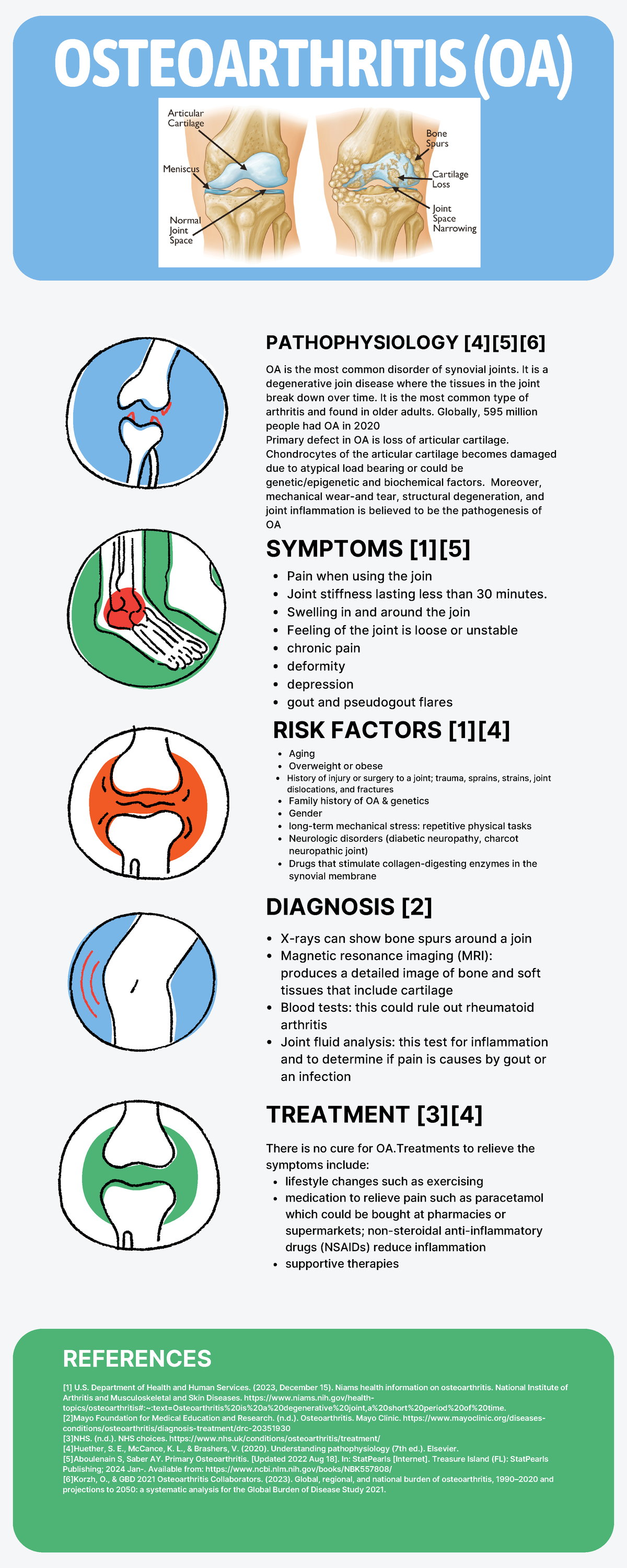 Info graphic week 15 - OSTEOARTHRITIS (OA) PATHOPHYSIOLOGY [4][5][6] OA ...